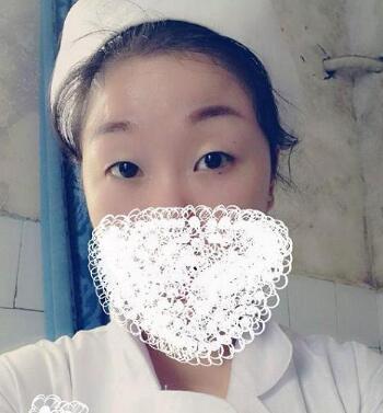 成都唯罗纳医疗美容门诊部夏正义医生双眼皮案例?