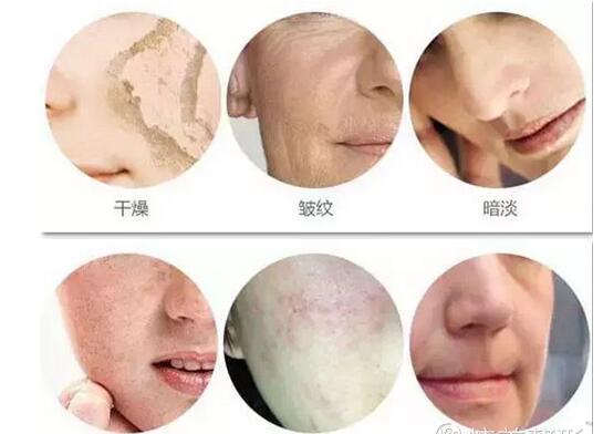 北京雅靓整形医院激光美肤怎么样