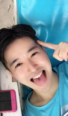 成都米兰柏羽康春雨专家双眼皮手术案例