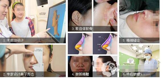 蚌埠东方美莱坞隆鼻怎么样？多少钱？