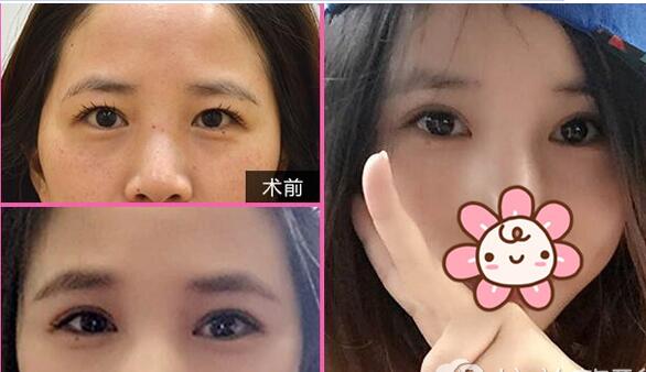北京新星靓是专业双眼皮修复医院吗?有修复价格表吗
