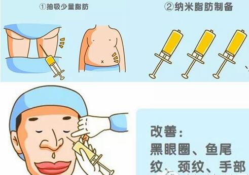 江西宜春天泽整形医院去黑眼圈怎么样?哪个专家好