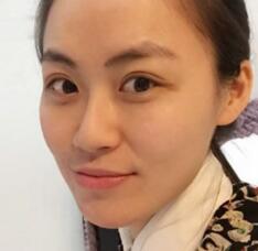 贵阳美贝尔割双眼皮怎么样？案例