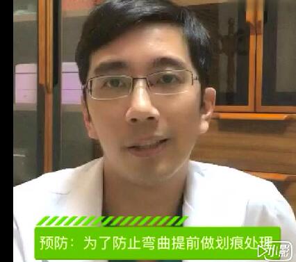 上海百达丽(伯思立)韩嘉毅肋软骨隆鼻案例分享